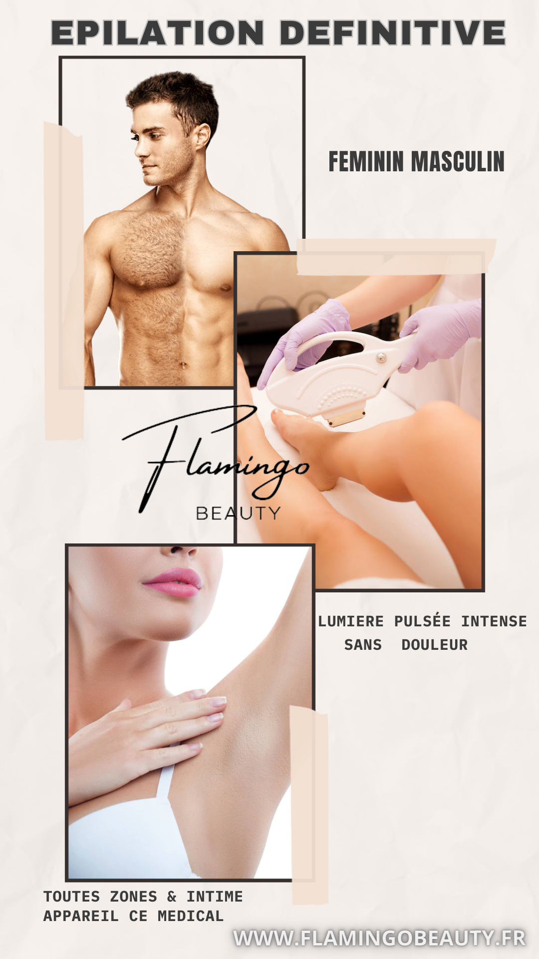 Epilation Nice définitive lumière pulsée - Cire jetable
